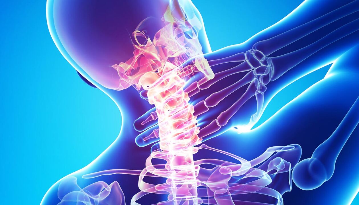 nyaki fájdalom osteochondrosis miatt